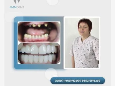 Mzia Nozadze